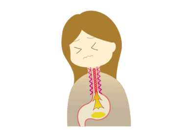 【医師監修】その胸やけ、逆流性食道炎かも？原因と放置するリスク、改善法を解説のアイキャッチ画像