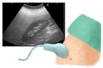 【医師が徹底解説】お腹の脂肪、見て見ぬふりしていませんか？「内臓脂肪」の危険な正体と、腹部エコーで「見える化」する重要性のアイキャッチ画像