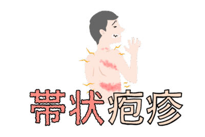 【50代から急増】その激痛、帯状疱疹かも？知っておきたい「ワクチン定期接種化」と2種類の選択肢のアイキャッチ画像