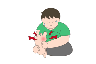 ある日突然、足の指に激痛が！痛風発作の原因と、ビール以外にも気をつけたい食事の注意点のアイキャッチ画像