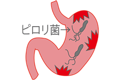 ピロリ菌